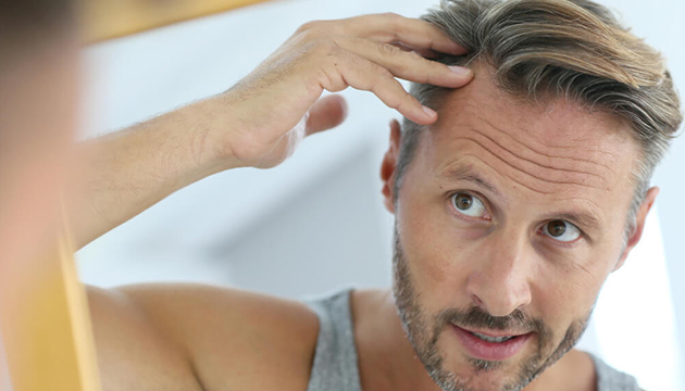 Combien d’heure dure la greffe de cheveux?