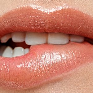 Remplissage des Lèvres (Lipofilling)