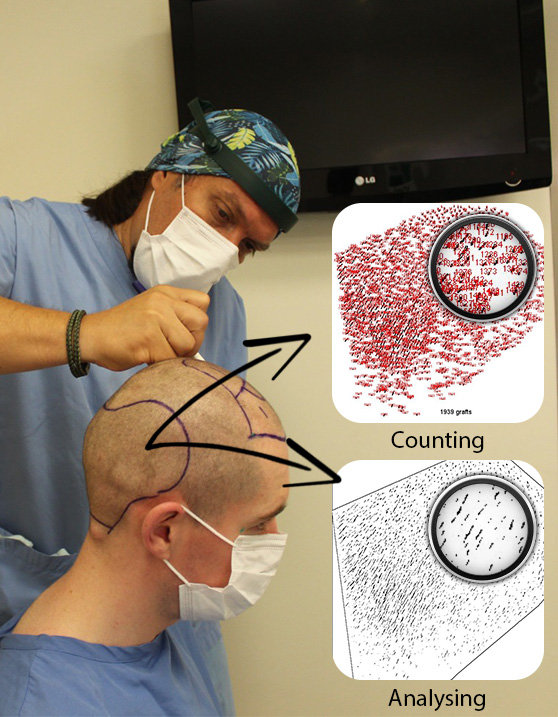 Micro-Determining the Donor Area