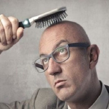 What Are the Main Causes of Hair Loss in Men?