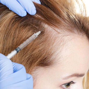 Can the Transplanted Hair Be Collected After a Hair Transplant for Women