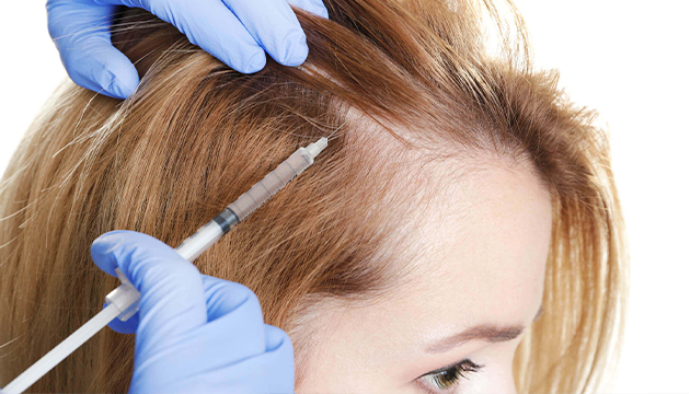 Can the Transplanted Hair Be Collected After a Hair Transplant for Women